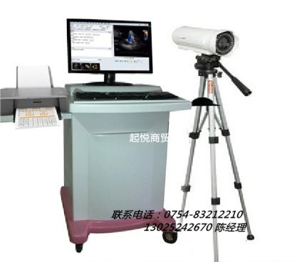 索尼電子數(shù)碼陰道鏡