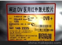 鑫俊公司專業(yè)供應(yīng)柯達(dá)醫(yī)用膠片