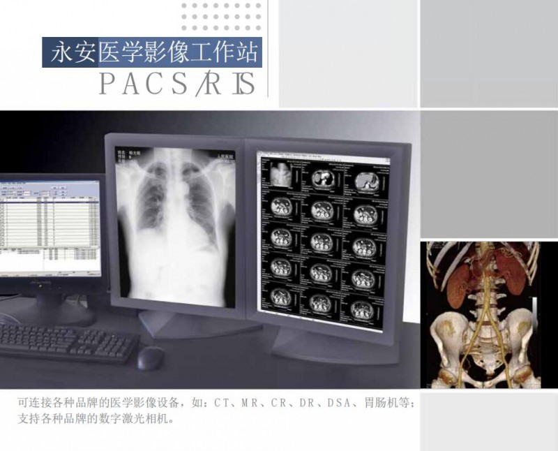 影像工作站（超聲、DR、CT、核磁）軟件廠家