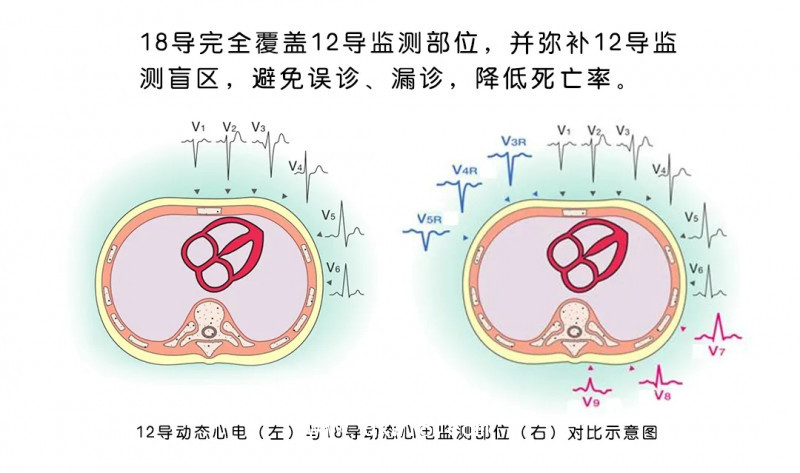 25.webp