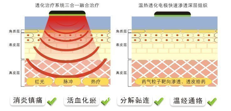 中頻理療儀 康復(fù)科甲類醫(yī)保新農(nóng)合100%報(bào)銷  觸摸屏操作
