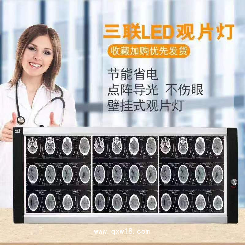 欣雨辰 YC-GP X射線膠片觀片燈 單聯/雙聯/三聯/四聯