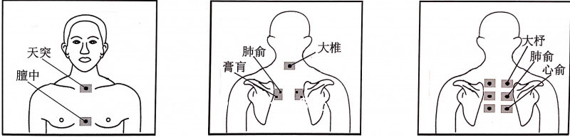 止咳貼穴位