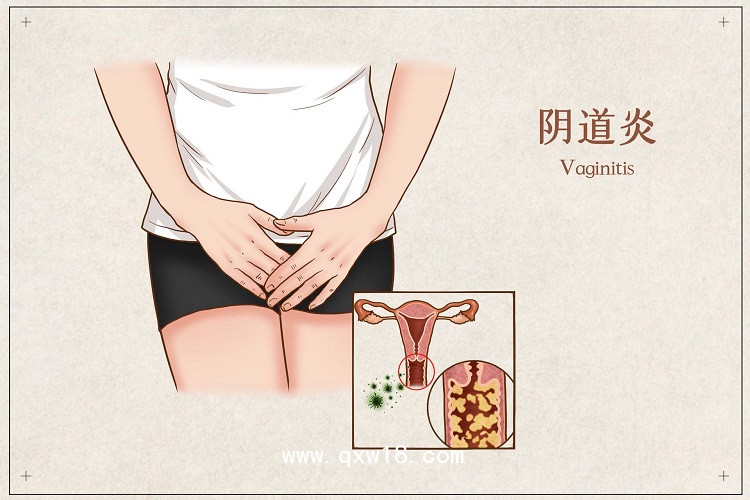 初鴻婦科臭氧治療儀ZJ-9000醫(yī)用豪華款