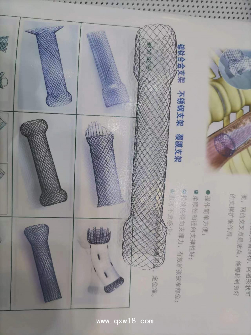 膽道支架
