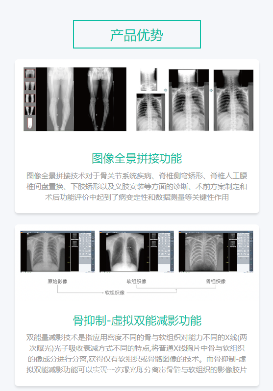 深圖SONTU 數(shù)字化X射線成像系統(tǒng) SONTU100-Polaris50