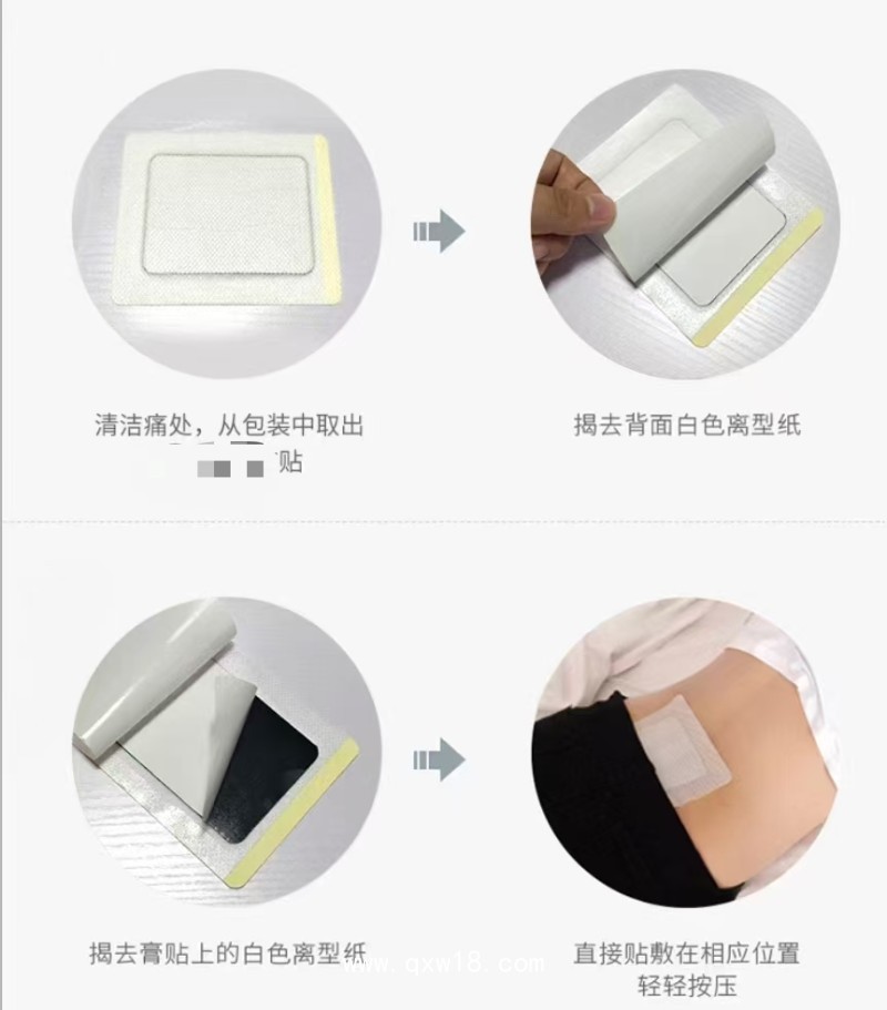 穴位貼敷治療穴