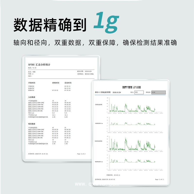 男性功能硬度勃起監(jiān)測(cè)一鍵查詢檢測(cè)參數(shù)男性功能生理多參數(shù)檢測(cè)儀