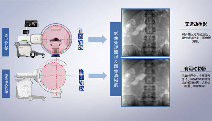 骨科三維C形臂機(jī)架設(shè)計(jì)對(duì)比圖